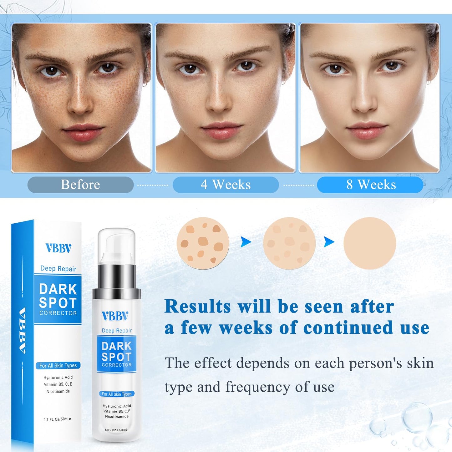 VBBV Dark Spot Remover for Face and Body, Dark Spot Corrector, Sun Spot Freckles Hyperpigmentation Treatment, Advanced Dark Spot Remover Cream Beauty & Personal Care VBBV