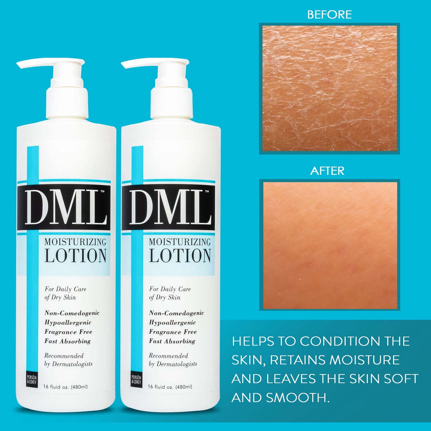 DML Moisturizing Lotion- Hydrating Hand and Body Moisturizer / Hypoallergenic Body Lotion for Dry and Cracked Skin / Gentle, Unscented Moisturizing Beauty & Personal Care DML