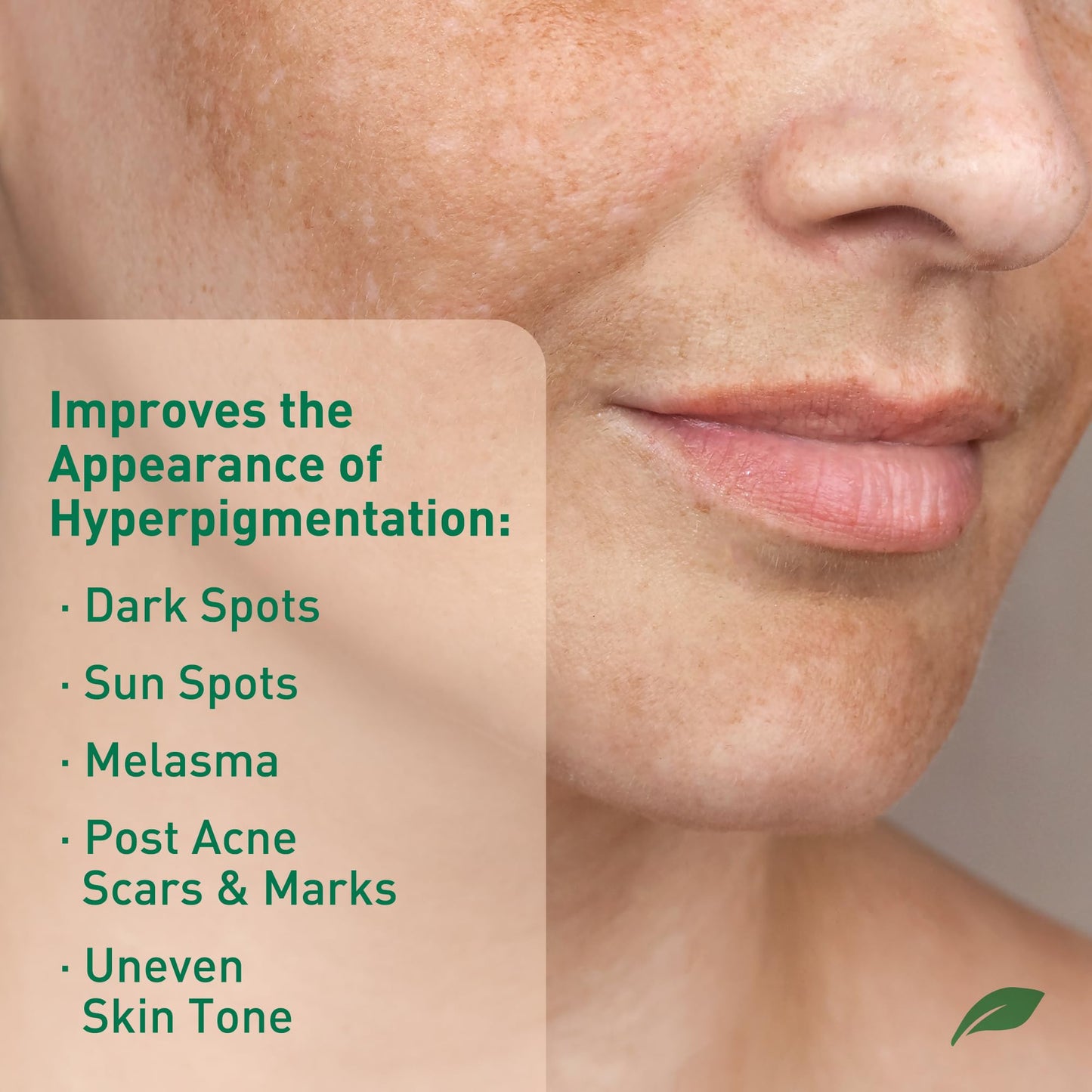 PROcure Dark Spot Corrector Serum - Alpha Arbutin, Niacinamide & Kojic Acid for Hyperpigmentation, Age Spots & Uneven Skin Tone - Hydroquinone-Free Beauty & Personal Care PROcure
