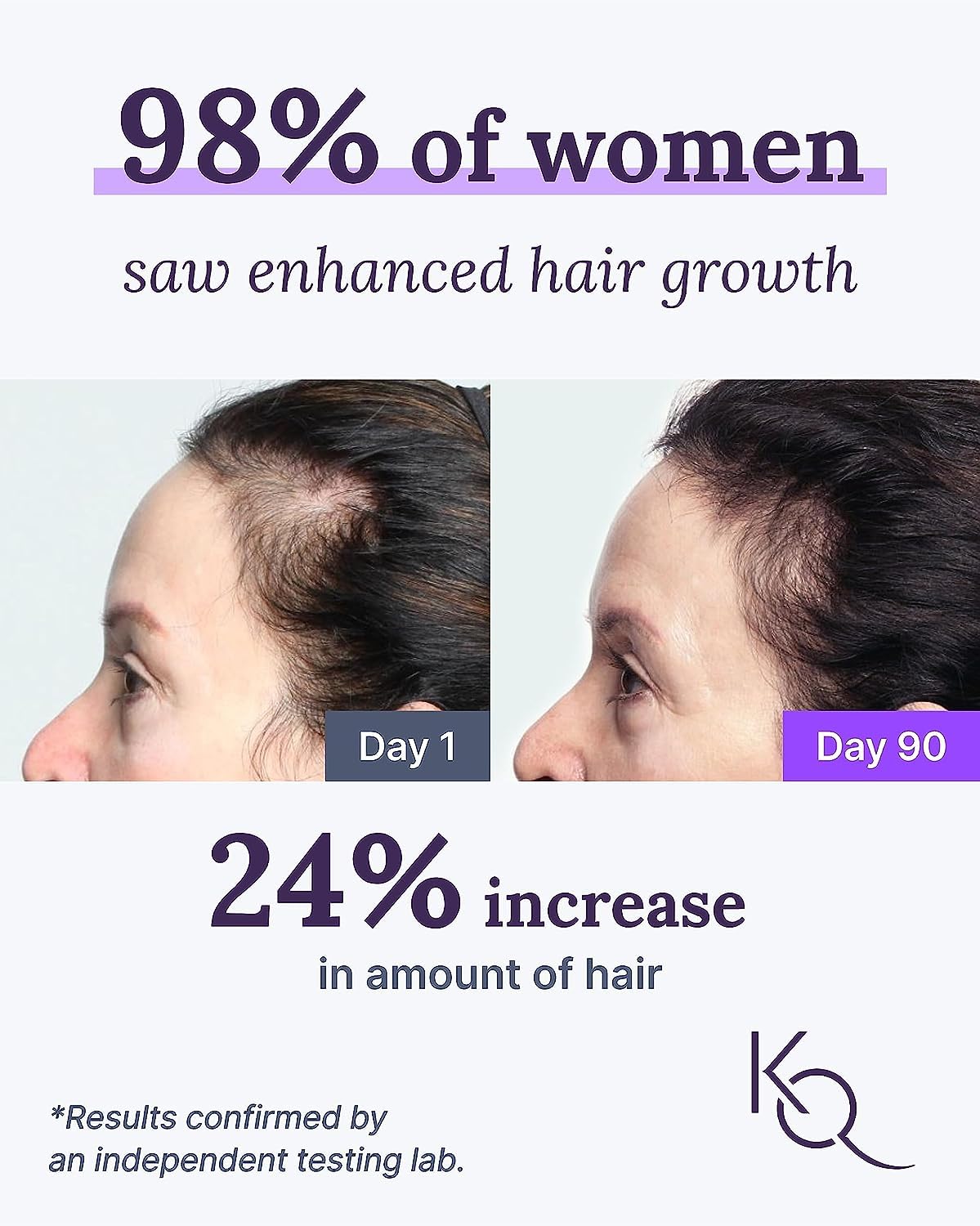 Keranique Hair Growth System - KeraViatin Vitamins with Biotin, Vitamin B, and Curcumin, Lift and Repair Treatment Spray for Instant Volume, 30 Days