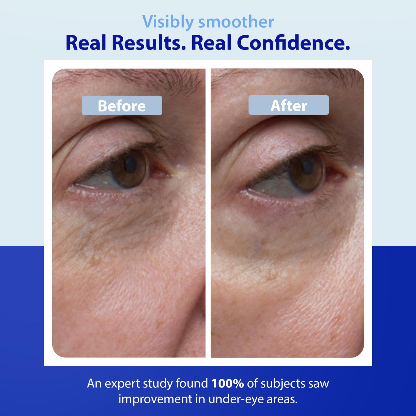 Dr. Denese SkinScience Firming Facial Collagen Eye Cream 0.5oz - Collagen, Hyaluronic Acid & Peptides for Smoother Under Eye Skin - Reduces Look Beauty & Personal Care Dr. Denese