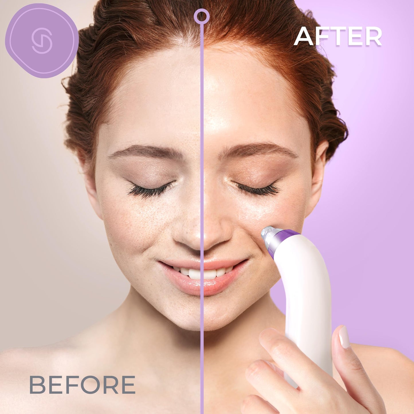 Essy Blackhead Remover Facial Cleanser Machine for Pimple Suction (Purple) Beauty and Personal Care Essy