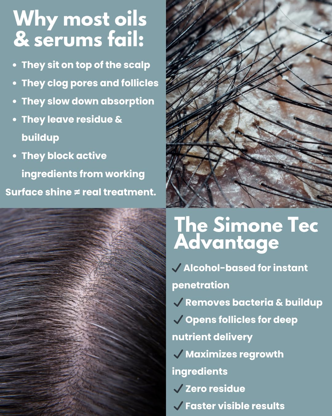 Simone Tec Hair Essentials Hair Loss Prevention Shampoo & Conditioner & Mask Set Capillary Proteins and Vitamins/Restore & Strengthens | Promo Dx2 Beauty & Personal Care Simone Tec Hair Essentials