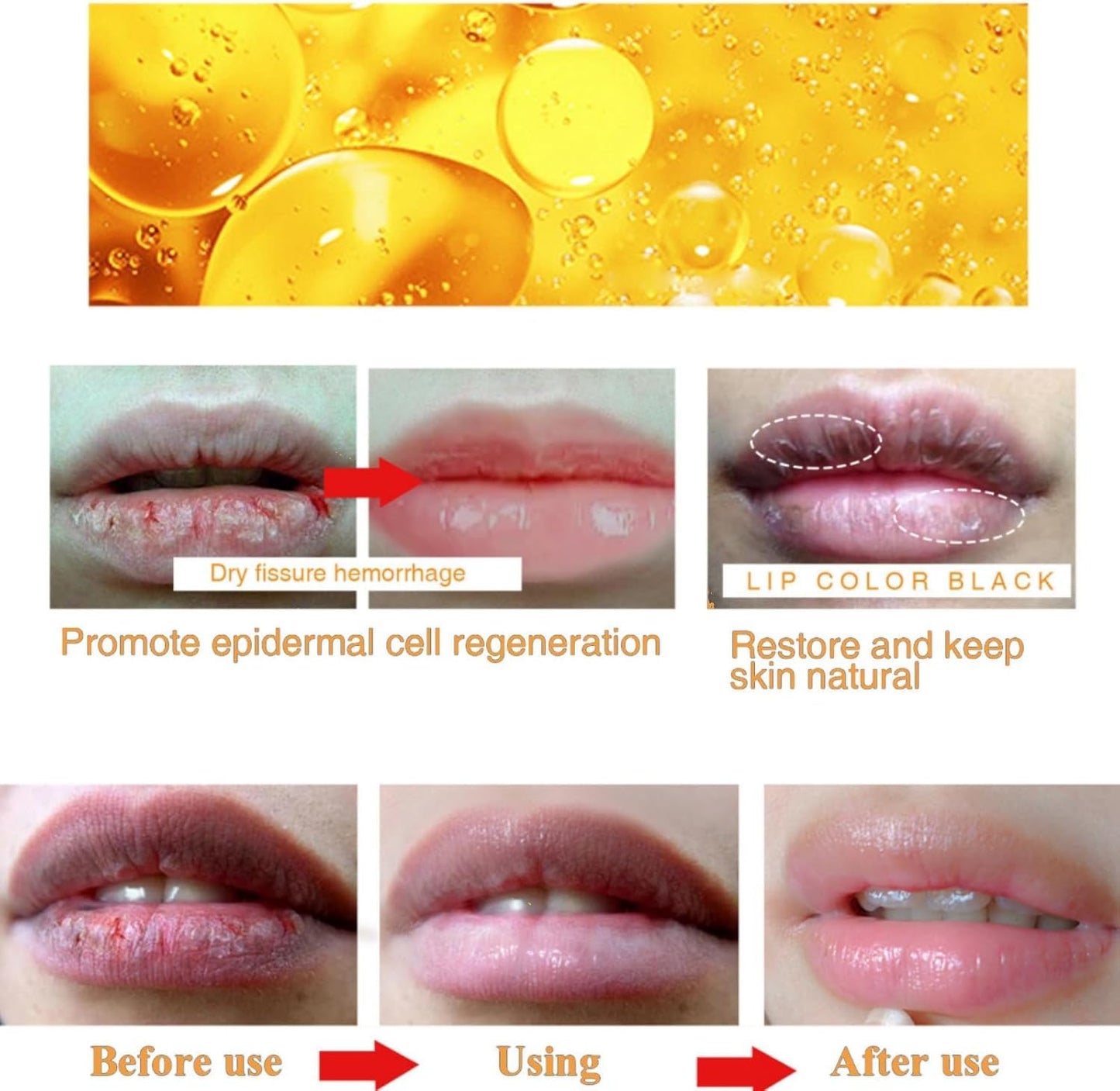 2PCS Lip Lightening for Dark Lips Lip for Smokers Dark Lip Treatment Lightening Cream for Pink Lips Lip Lightener for Smoker Lips Lip Lightening balm Beauty and Personal Care MSECVOI