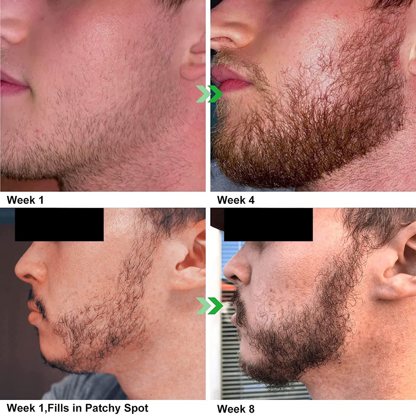 Unscented Beard Oil - Natural, Non-GMO, Facial Hair Hydrating & Conditioning Oil Blend - 32 oz - Bulk Sized, Promoting Growth and Silky Smooth Hair Beauty & Personal Care OPO