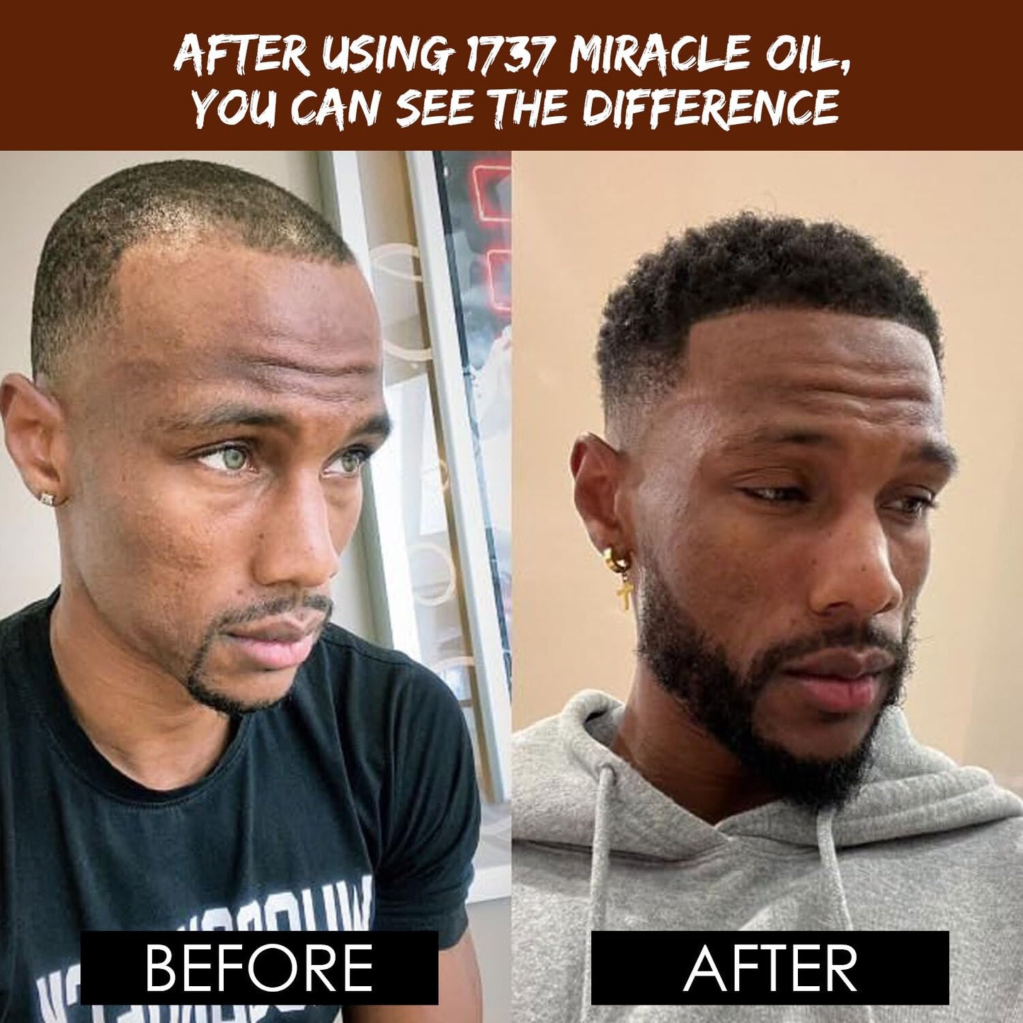 Dixon's 1737 Miracle Oil, Natural Organic Beard, Scalp, Hair Oil for Softening, Shine, Breakage Reduction, Scalp Hydration Organic Nourishment (2 fl Beauty and Personal Care Dixon's 1737