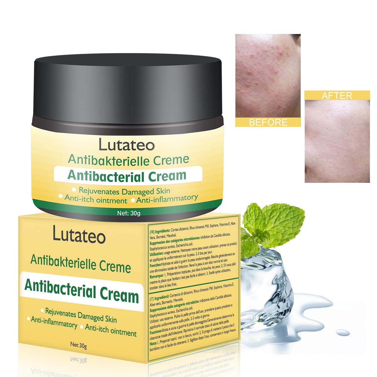Gold Bond Ultimate Aloe Cream 14oz Pump (3 Pack) Beauty & Personal Care Gold Bond