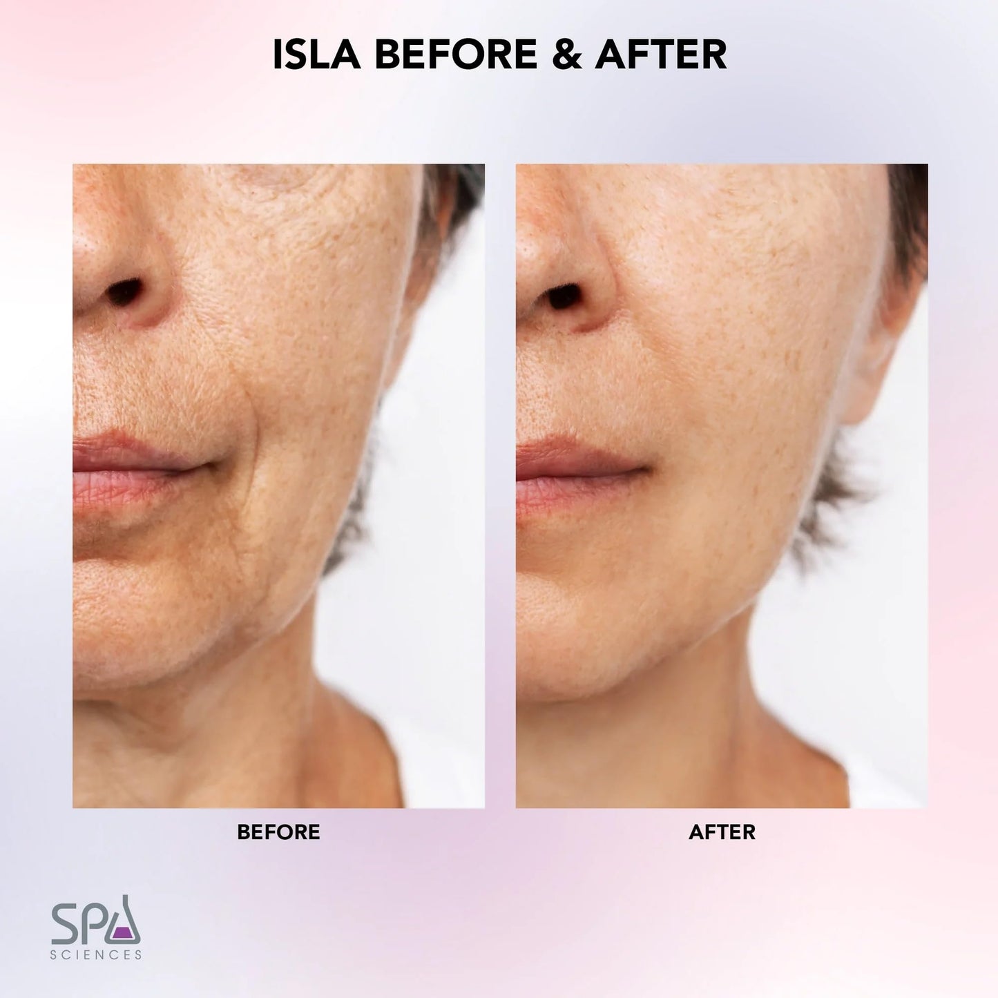 Spa Sciences ISLA Ice + Heat Contouring Roller (Face, Neck, and Décolletage) - Including Steel + Bonus Genuine Rose Quartz Globes Beauty & Personal Care SPA SCIENCES