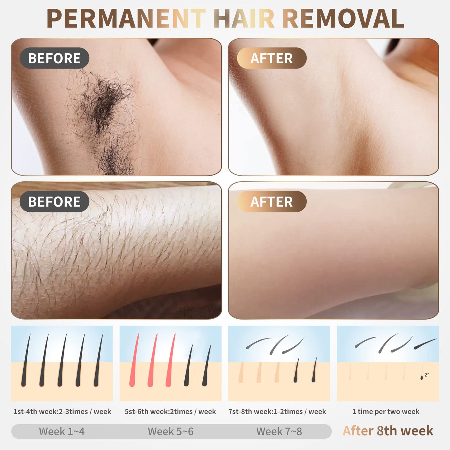 IPL Laser Hair Removal Device for Women & Men - At-Home Painless Ultra-Fast Flash Hair Remover, 86% Hair Reduction in 4 Weeks, High Energy & 5 Modes Beauty and Personal Care Gransumr
