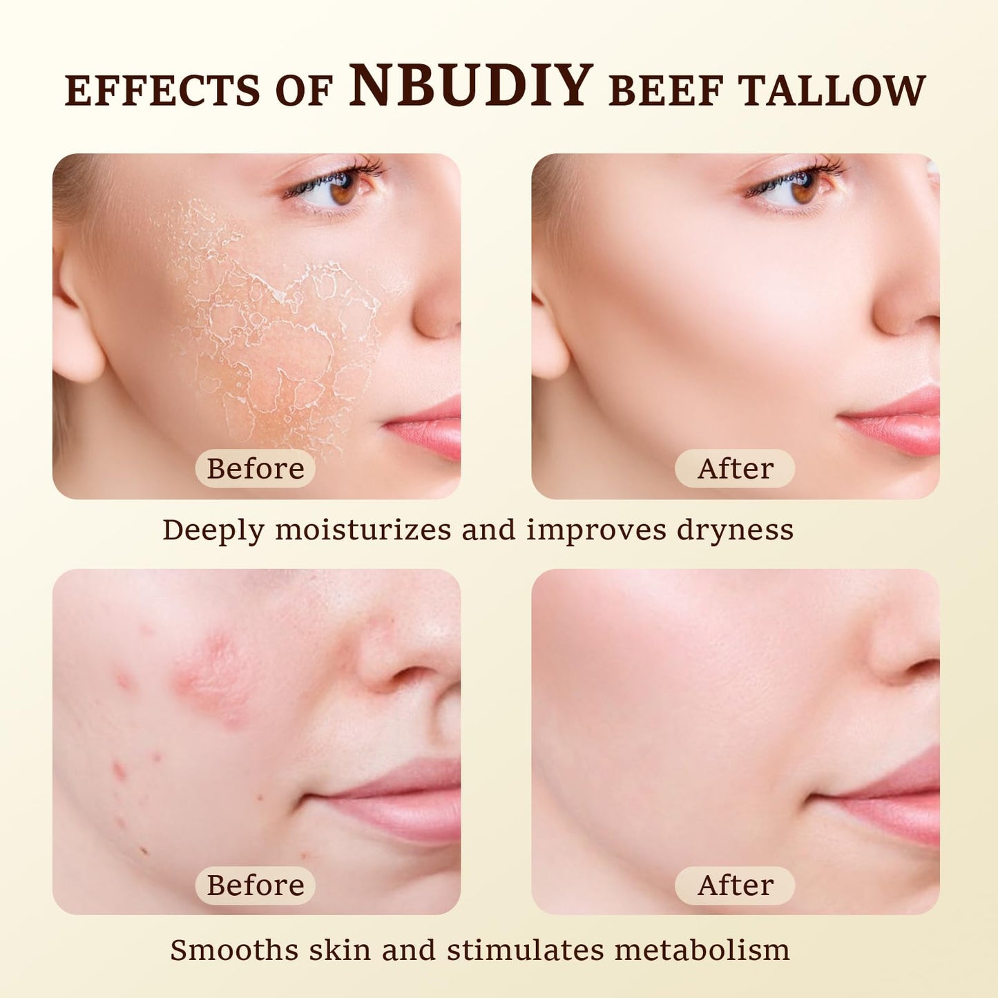 NBUDIY Beef Tallow for Skin, Tallow and Honey Balm, Tallow Face Moisturizer, Grass Fed Beef Tallow for Face - Sensitive Dry Skin Repair, Deeply Beauty & Personal Care NBUDIY