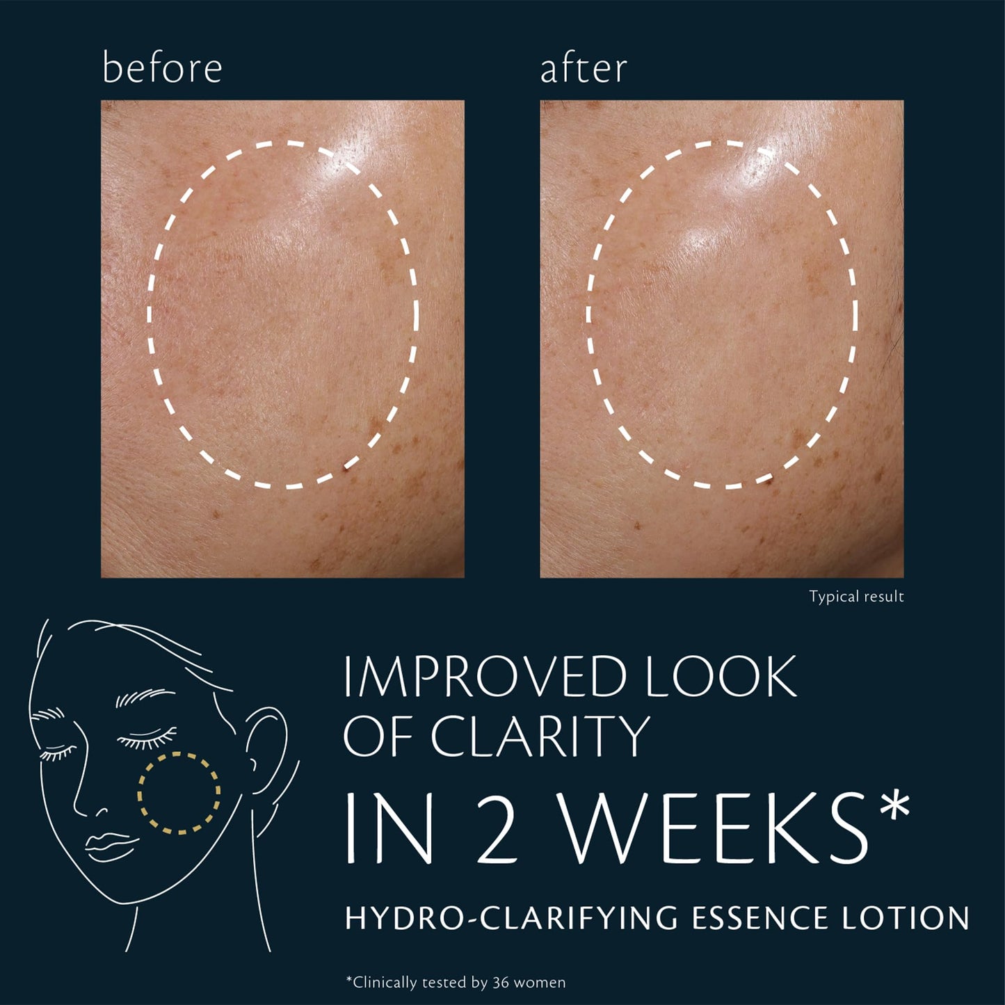 Hydro-Clarifying Essence Lotion Beauty & Personal Care Clé de Peau Beauté