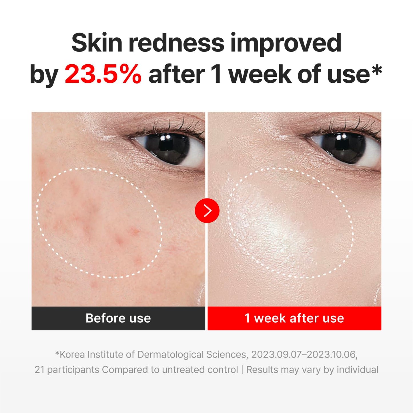 CENTELLIAN 24 Madeca Cream Time Reverse - Firming Face Moisturizer with TECA Centella Asiatica, Skin Elasticity & Barrier Support, Deep Hydration Beauty and Personal Care CENTELLIAN 24