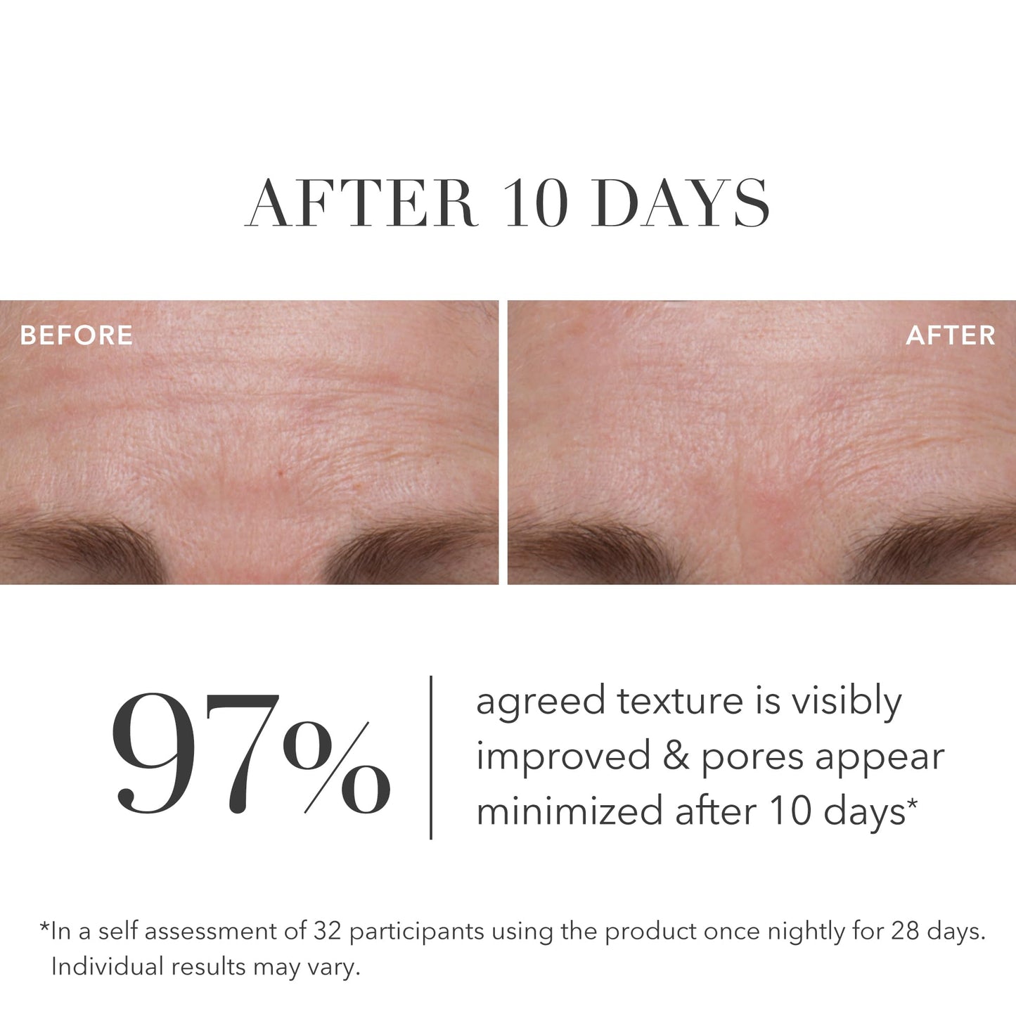 Algenist Green Microalgae Retinol+ Regenerating Serum - Gentle Anti Aging Retinol Face Serum with Time Release Retinol, AHA BHA PHA - Helps Improve Beauty & Personal Care Algenist
