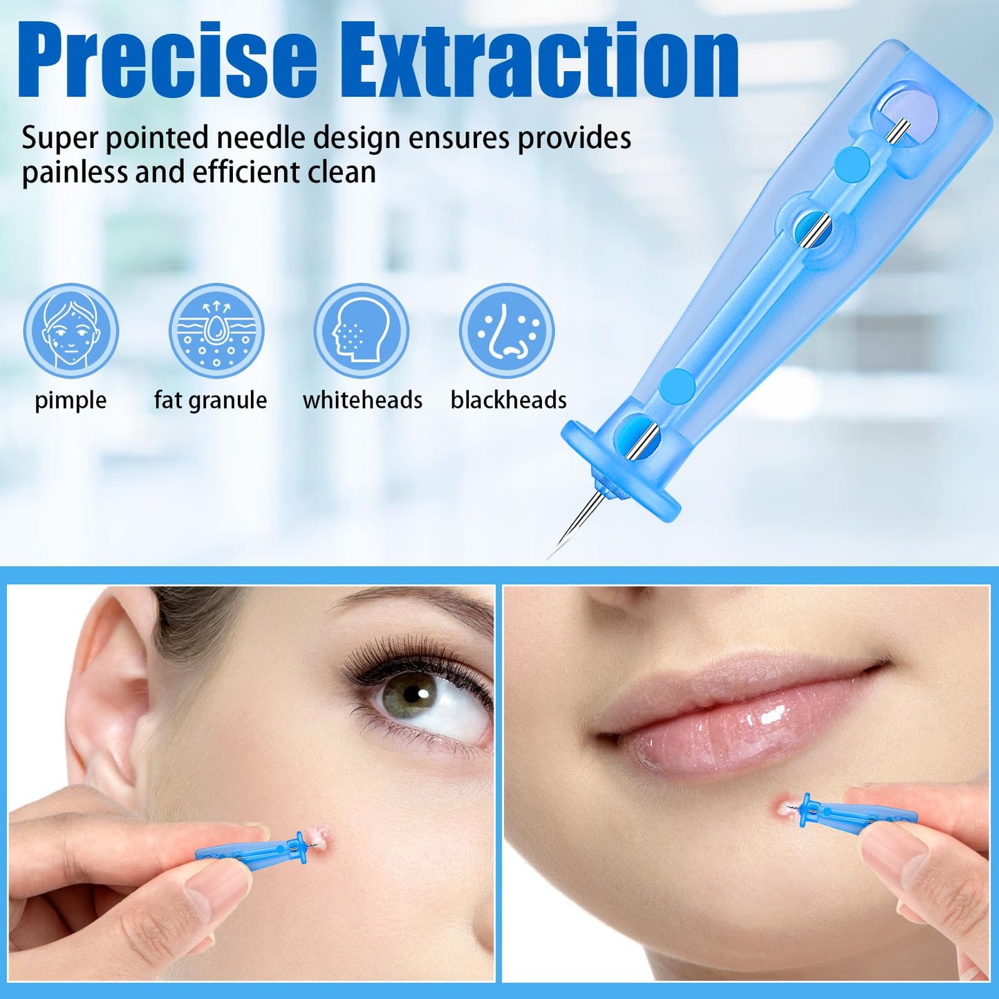 Lancets for Facial Extraction, 100Pcs Disposable Acne Needle Effective Blemish and Blackhead Removal Tools for Clear Skin Beauty and Personal Care HFYHWT