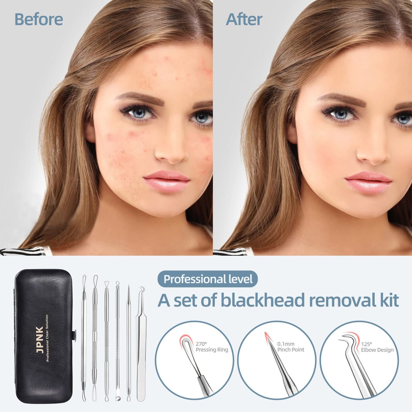JPNK Blackhead Remover Comedone Extractor Acne Removal Kit.. Beauty and Personal Care JPNK
