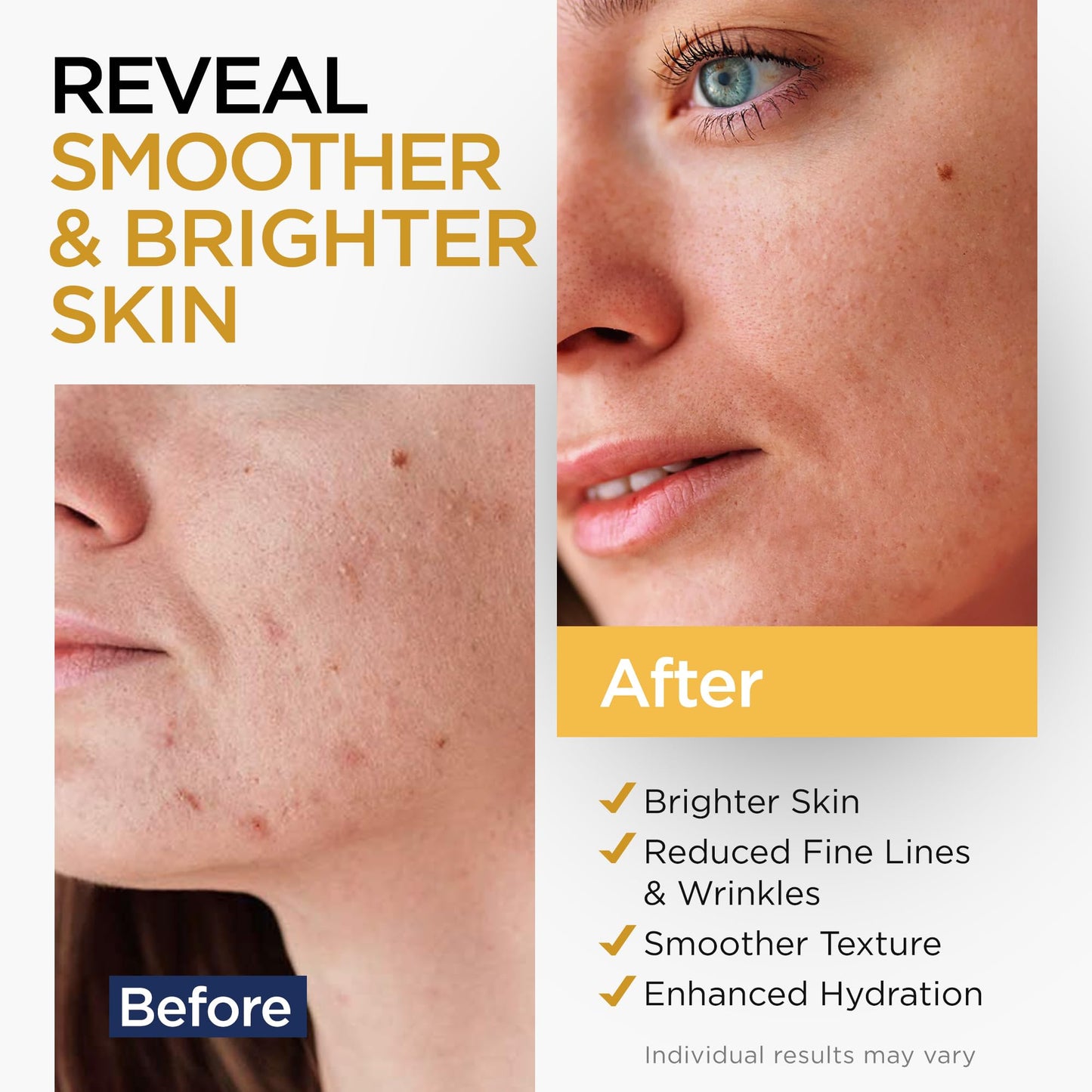Vitamin C Serum for Face with Stem Cells Hyaluronic Acid Aloe Vera Vitamin E Anti-Aging Face Serum Supports Skin Health & Even Tone All Skin Types Beauty and Personal Care Ember Cloud