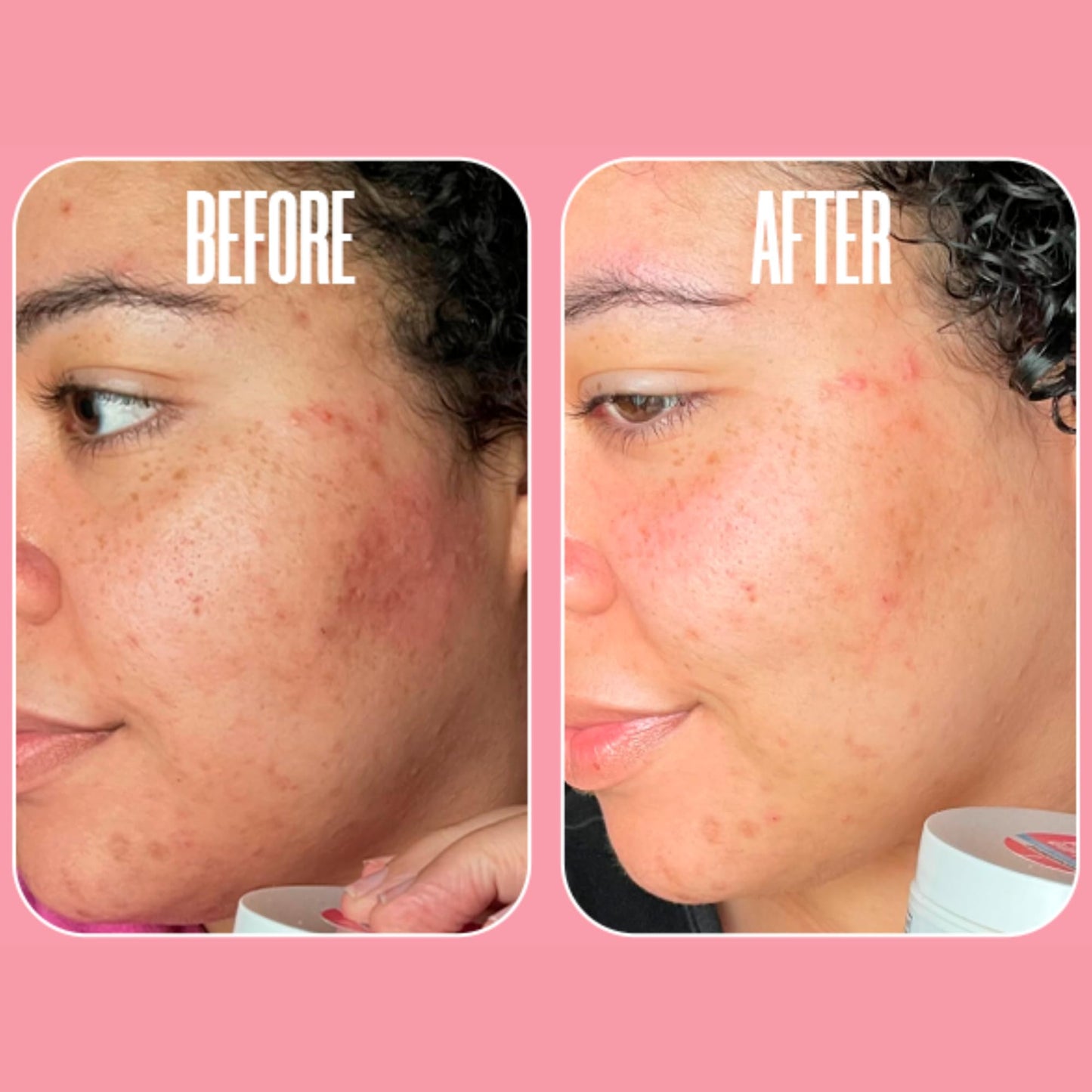 Glycolic Acid Pads with Vitamin C - Toner Pads for Face Cleansing With Tea Tree Oil - Exfoliating Pads with 20% AHA & Vitamins E, B3, B5 - Facial Peel Beauty & Personal Care Divine Derriere