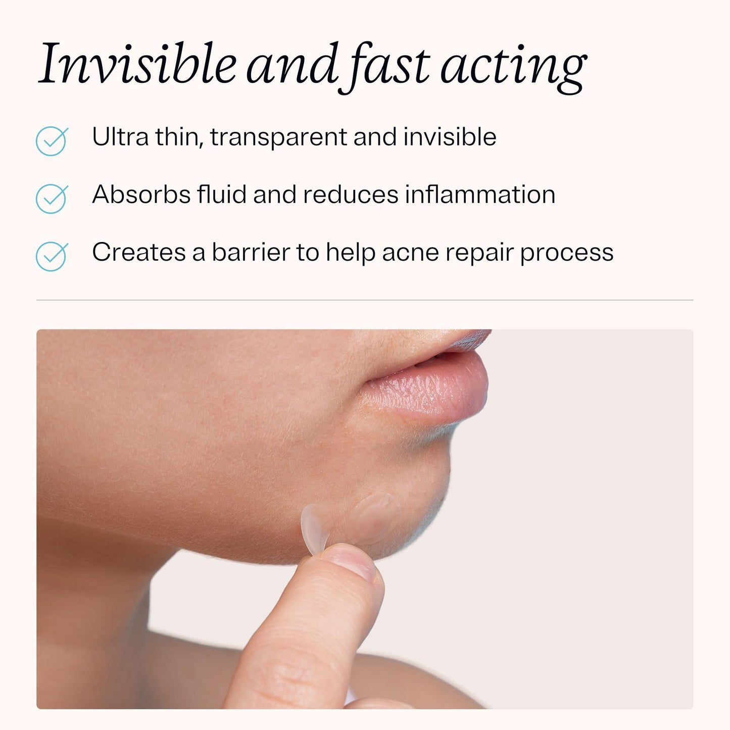 MDacne Pimple Patches for Acne Treatment, Hydrocolloid Patches - Absorbs Oil & Pus from Clogged Pores, Ultrathin & Transparent Blends with All Skin Beauty & Personal Care MDacne