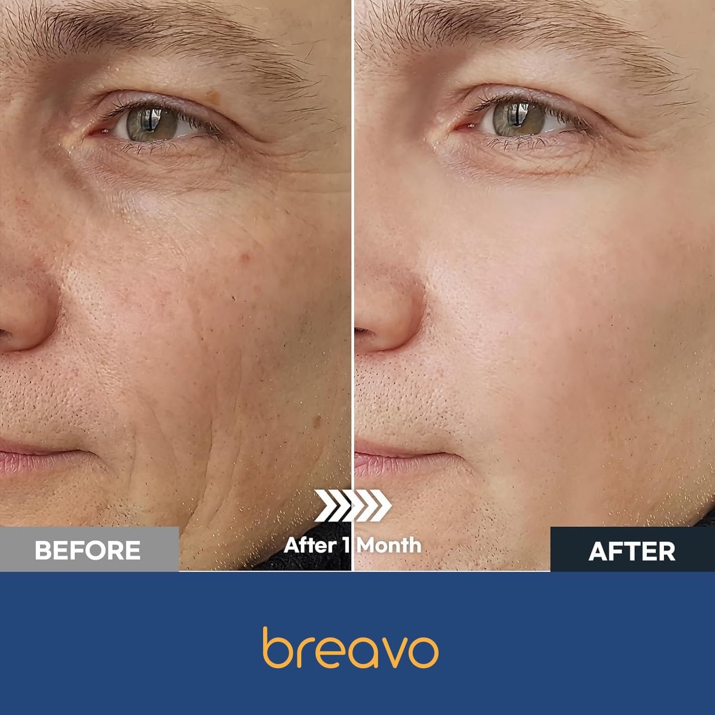 Breavo 6 in 1 Face Cream for Men: 6 in 1 Mens Face Moisturizer, Mens Face Cream Anti Aging - Eye Bags Treatment & Wrinkle Cream for Men 1.7 oz Beauty & Personal Care Breavo