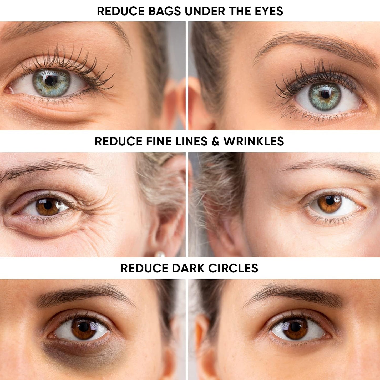 Instant Eye Tightener - Removes Under Eye Bags & Puffiness. Eliminate Dark Circles & Wrinkles. Naturally Ageless Hydrating Cream. Disappears Before Beauty & Personal Care Instaderm