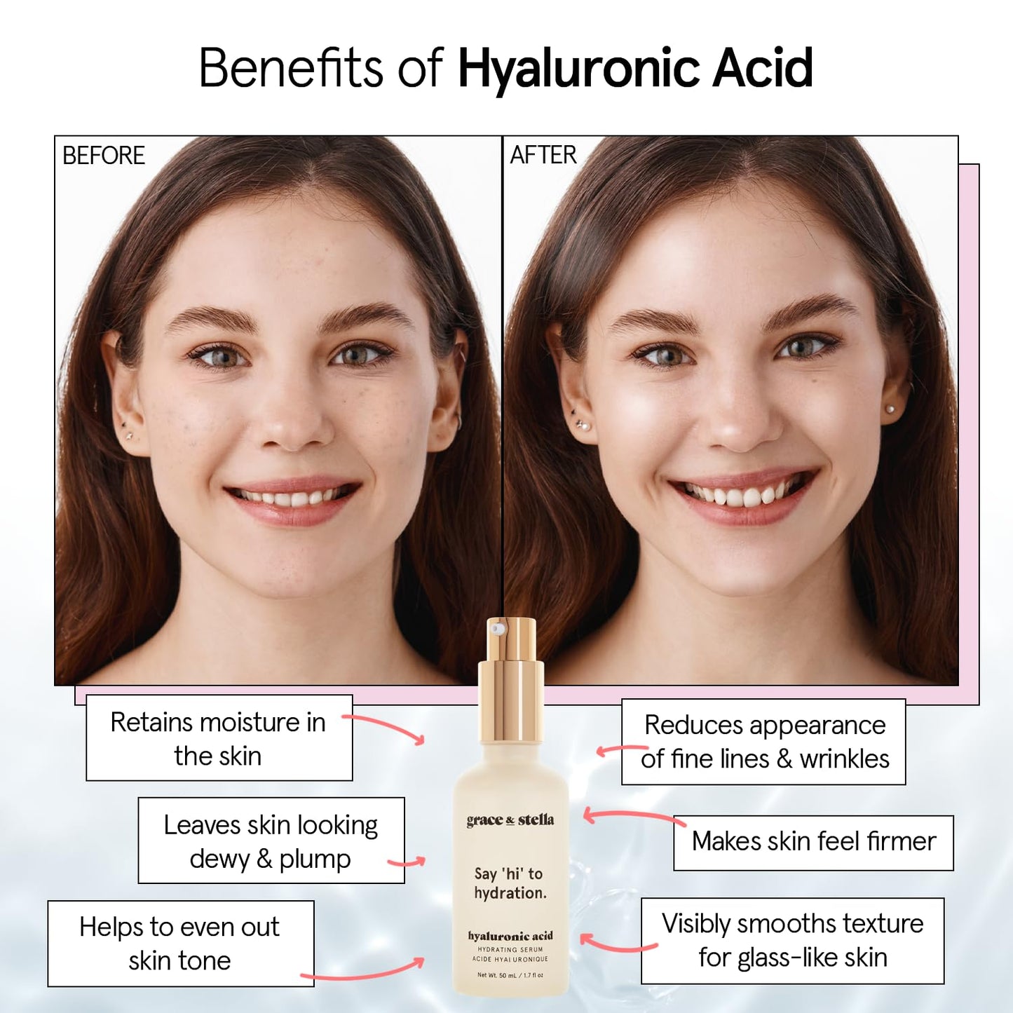 grace & stella Award Winning Hyaluronic Acid Face Serum (50ml/1.7 fl oz) Removes Fine Lines & Wrinkles, Hydrating Hyaluronic Acid Serum for Face Beauty and Personal Care grace & stella