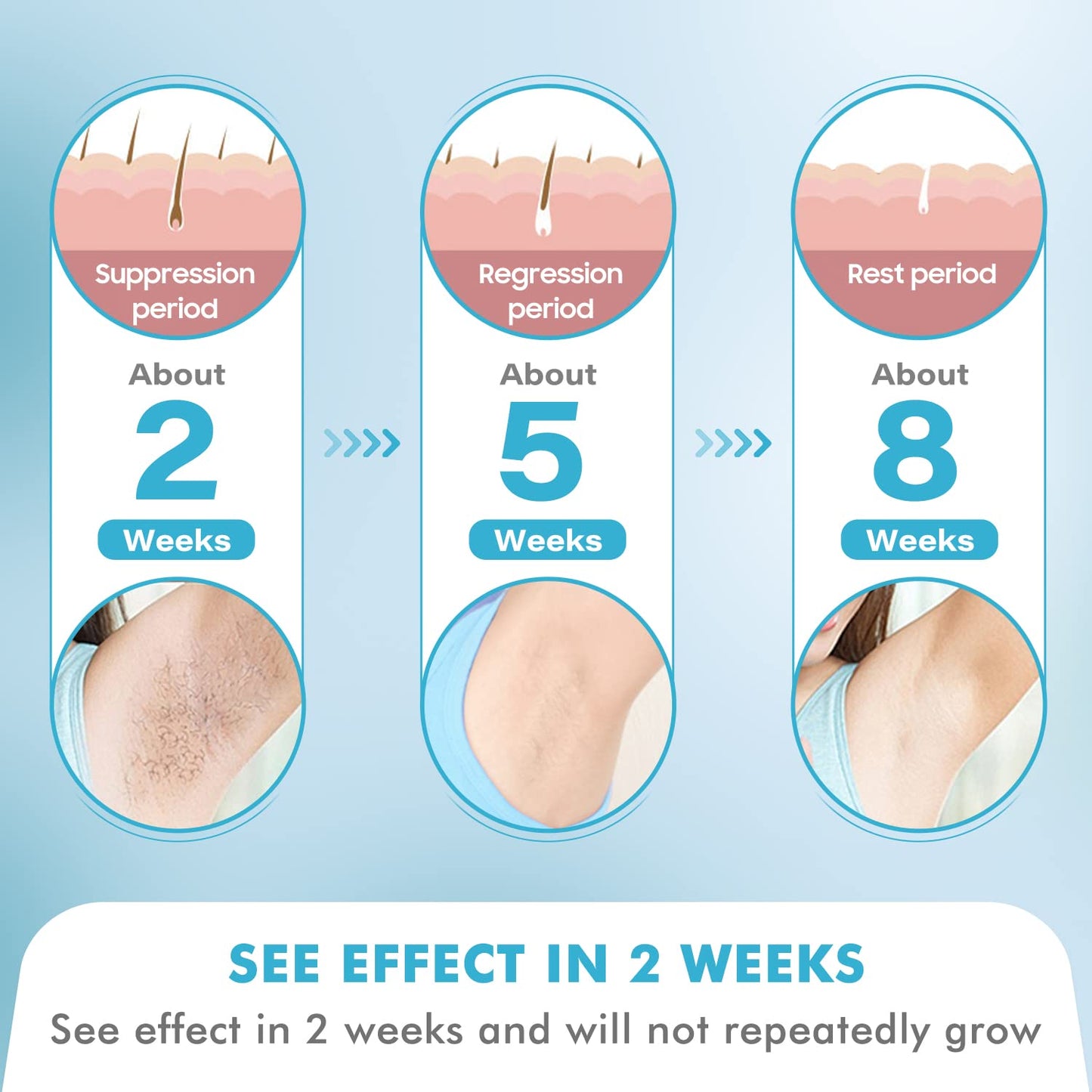 at-Home Hair Removal for Women and Men, DOPI Painless Hair Removal Device with Sapphire Cooling, Safe and Long-Lasting for Reducing in Hair Growth Beauty and Personal Care DOPI