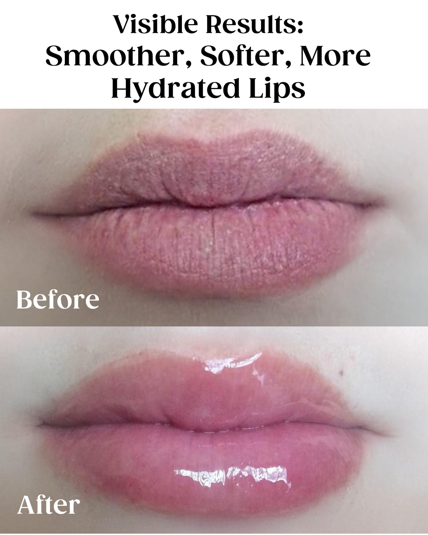 KAPLAN MD Perfect Pout Duo Lip Mask (0.5 oz.) & Lip Balm 0.17 oz. - Complete Anti-Aging Skin Care for Lips Beauty & Personal Care KAPLAN MD