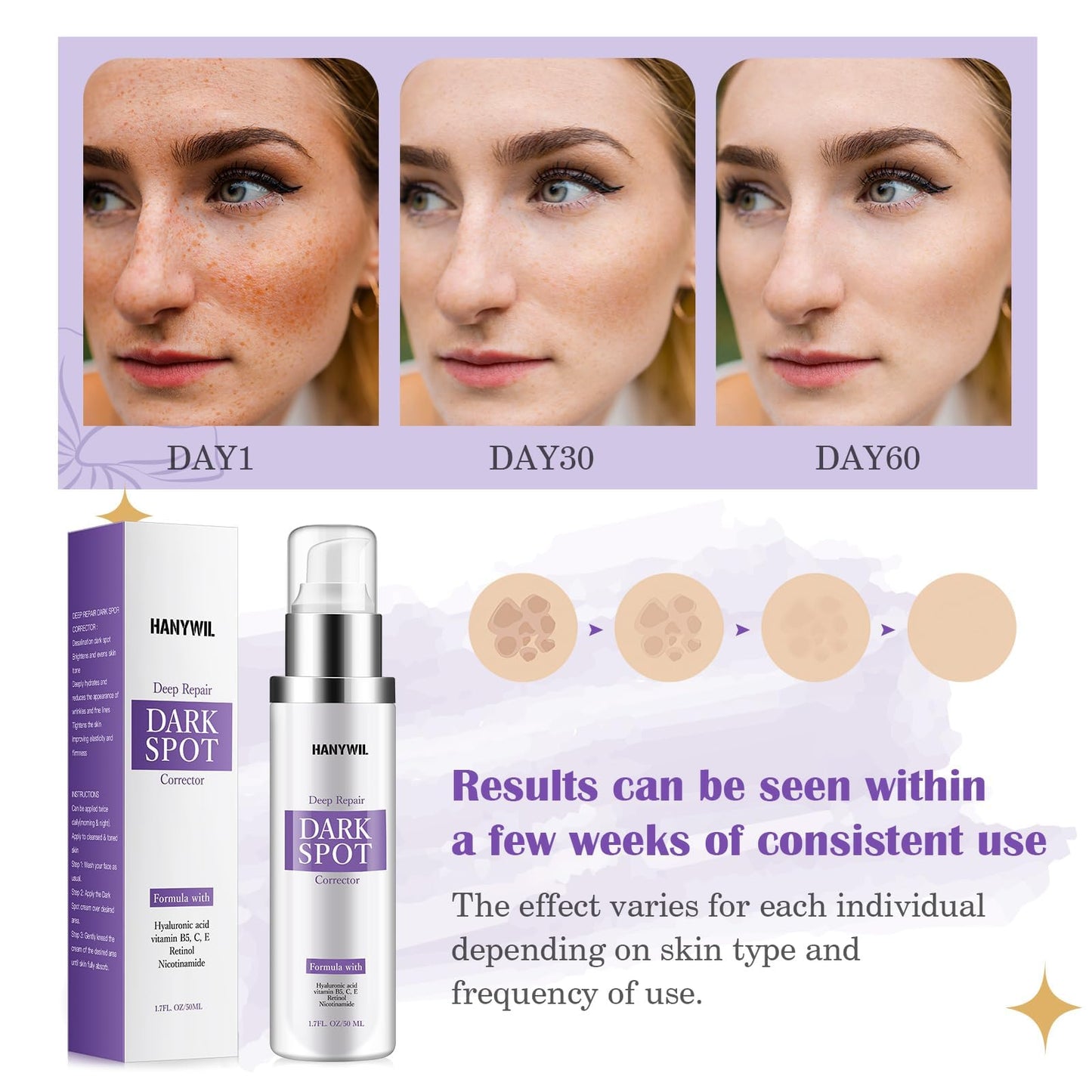 HANYWIL Dark Spot Remover for Face & Body Serum - 2% Retinol + 5% Niacinamide + Vitamin C for Face & Body, Melasma & Hyperpigmentation Beauty & Personal Care HANYWIL