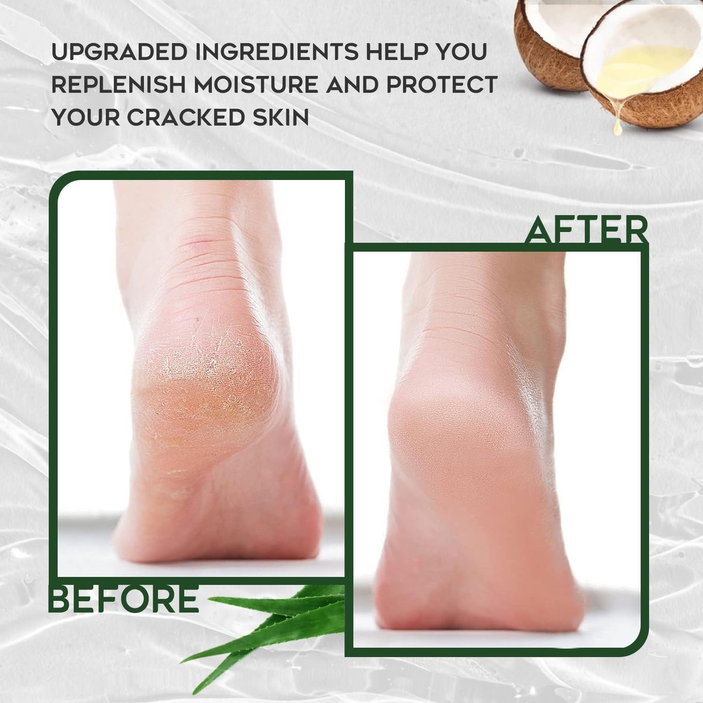 Vebuni Urea Cream 42% Foot Cream Salicylic Acid 4 Oz, Upgraded Callus Remover For Feet, Knees& Elbows, Intensive Moisturizes & Softens Skin Beauty & Personal Care Vebuni