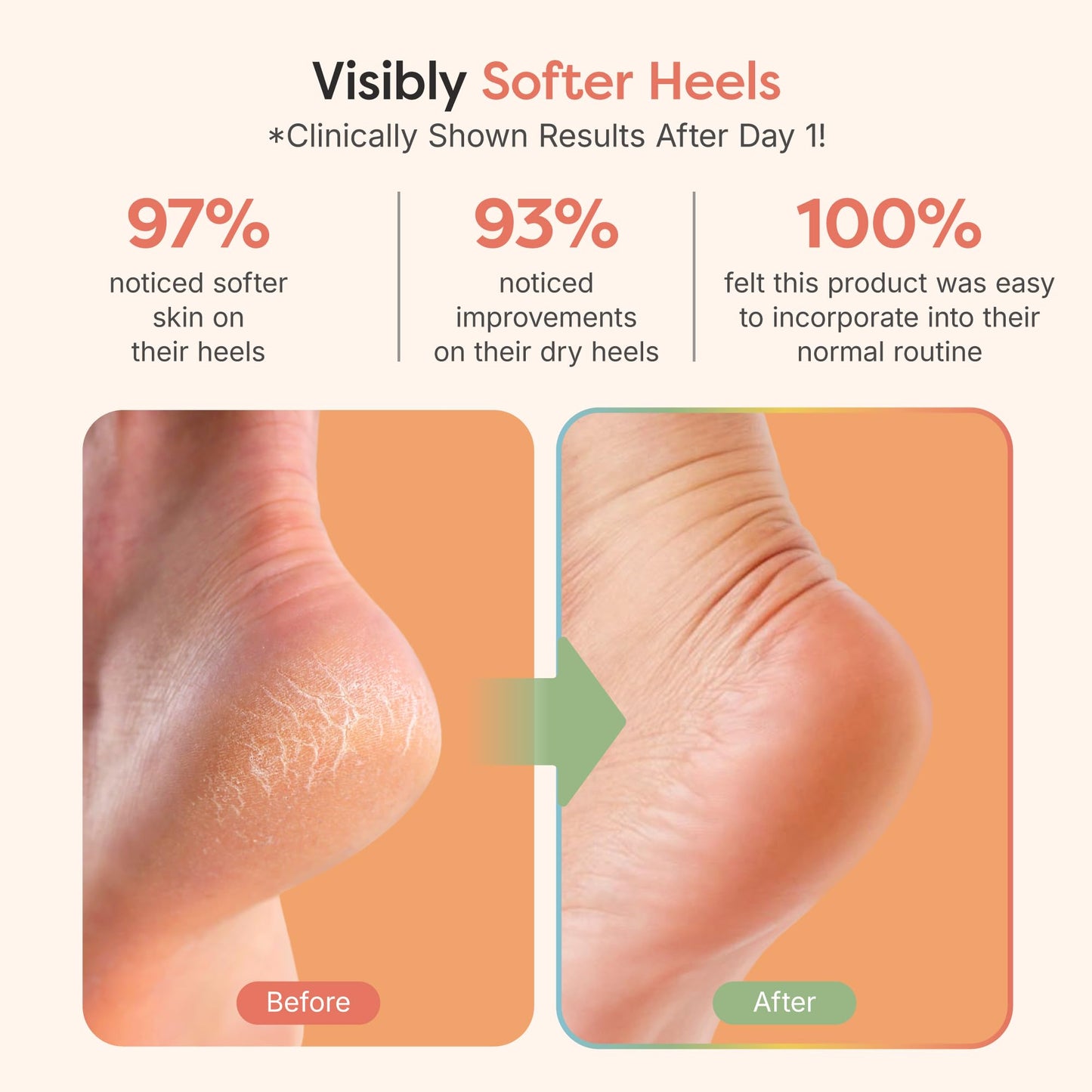 ZenToes Moisturizing Heel Socks for Dry Cracked Heels, 2 Pairs Beauty and Personal Care ZenToes