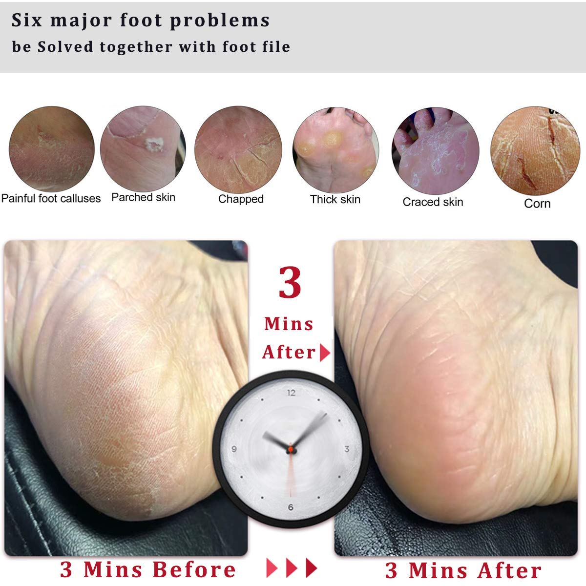 Kinepi Foot File Callus Remover Foot Scrubber,Professional Pedicure Foot Rasp Removes Cracked Heels,Dead Skin,Corn,Hard Skin,Pumice Stone for Scraper Beauty & Personal Care Kinepi