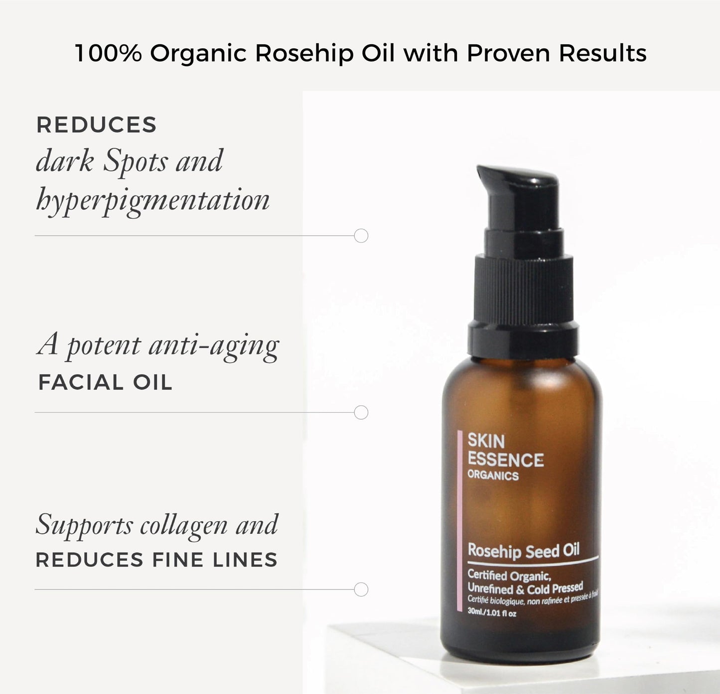 Skin Essence Organics Rosehip Seed Oil - Authentic, Cold-Pressed, & Certified Organic (30ml) Beauty & Personal Care Skin Essence Organics