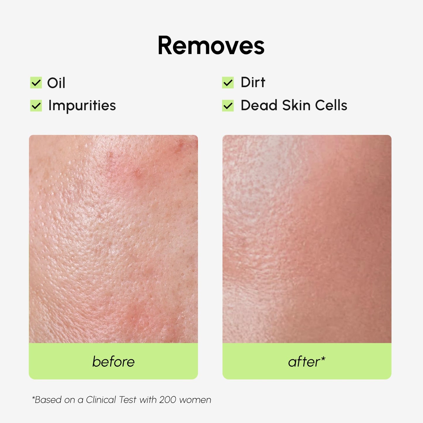 MAREE Exfoliating Toner with Salicylic Acid - AHA BHA Face Exfoliant & Pore Cleaner - BHA Liquid Exfoliant for Sebum & Dead Skin Care Remover - Face Beauty and Personal Care MAREE