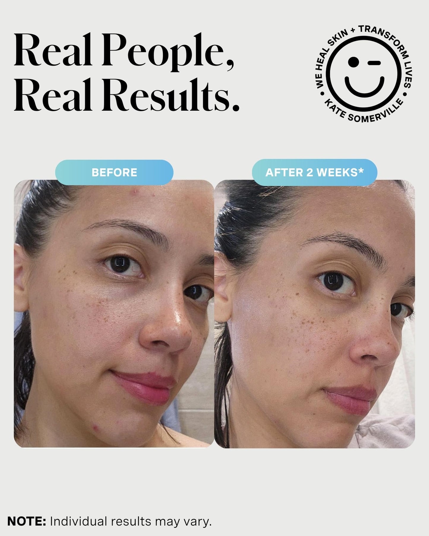 Kate Somerville EradiKate 3% Sulfur Daily Foaming Cleanser Acne Treatment - Clinically Formulated Medicated Face Wash Balances Skin & Cleans Pores, 4 Beauty and Personal Care Kate Somerville