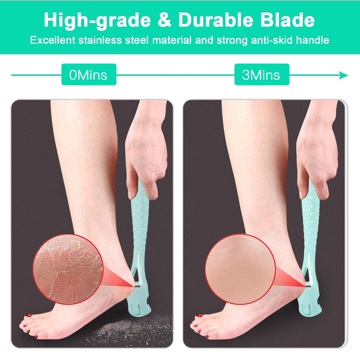 Foot Care Pedicure Callus Shaver Hard Skin Remover, Sichy Heel Scraper for Feet, 10 Replacement Slices 1 Stainless Steel Callus Shaver Foot Care Tools Beauty & Personal Care Sichy