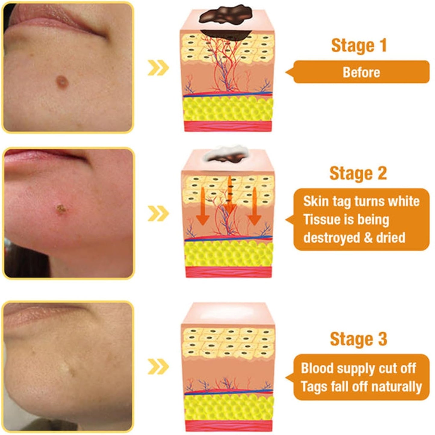Bee Venom Skin Treatment Cream, 2024 New Bee Venom Repair Cream, Professional Bee Venom Cream-30g, Repair Maximum Strength for All Skin Types (1 Beauty & Personal Care AEEHFENG