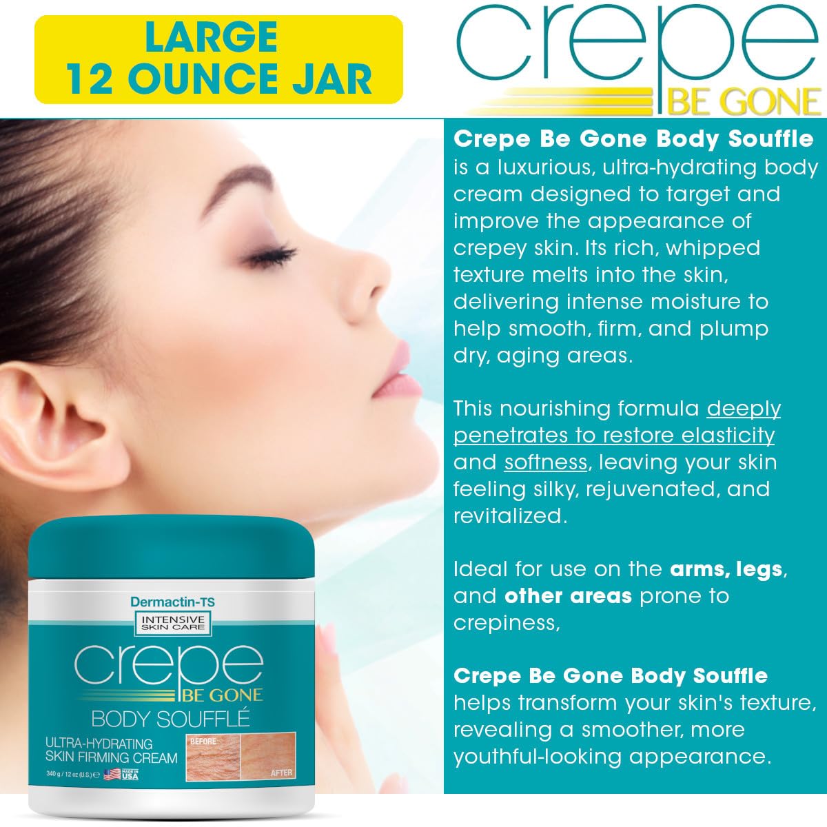 Dermactin Crepe Be Gone Body Souffle Classic - Large 12 ounce - Ultra Hydrating Crepe Skin Firming Cream for Neck,Chest, Arms & Legs
