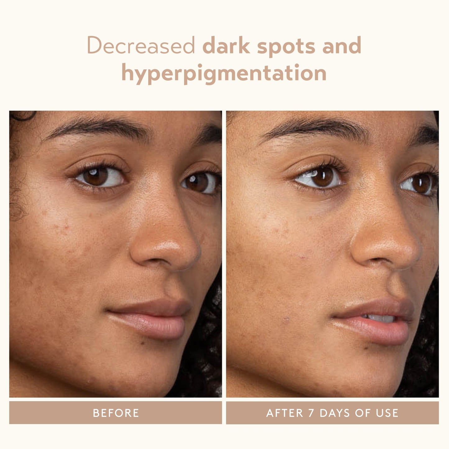 SHANI DARDEN SKIN CARE Lactic Acid Face Serum, Active Night Serum to Help with the Look of Radiant and Smooth Skin, Gentle But Powerful Face Beauty & Personal Care SHANI DARDEN