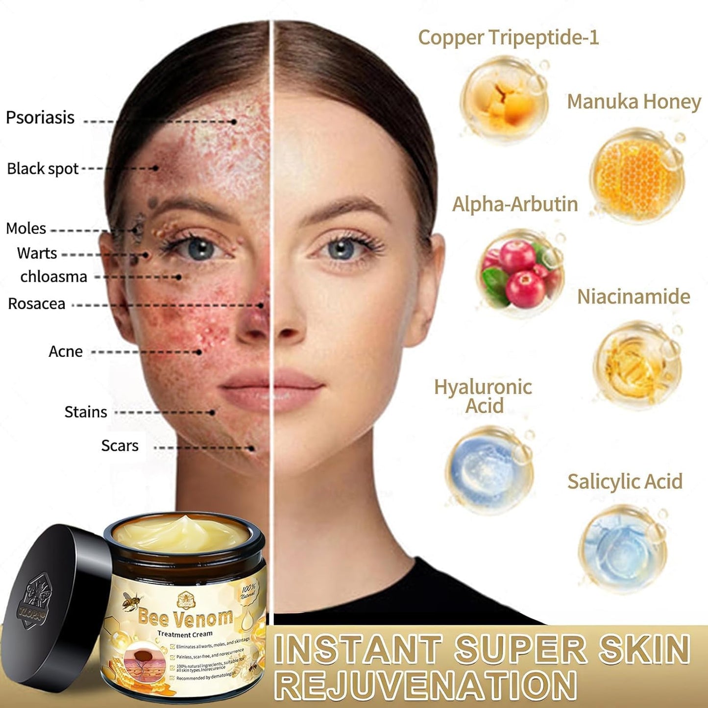 Bee Venom Skin Treatment Cream, 2024 New Bee Venom Repair Cream, Professional Bee Venom Cream-30g, Repair Maximum Strength for All Skin Types (1 Beauty & Personal Care AEEHFENG