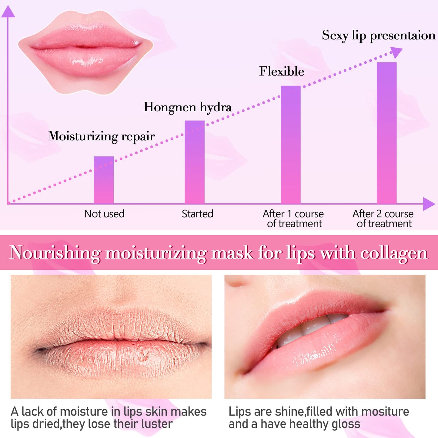Kipeber 50PCS Lip Mask Sheet,Collagen Crystal Lip Masks,Pink Lip Care Pads Mask for Moisturizing Nourishing,Anti-Aging & Anti-Wrinkle,Lip Gel Patches Beauty & Personal Care Kipeber