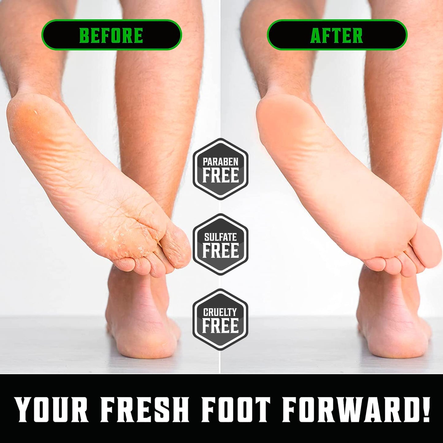 Viking Revolution Tea Tree Foot Cream for Dry Cracked Heels - Foot Balm For Cracked Feet - Dry Feet Repairing Cream with Aloe Vera and Mint (8oz) Beauty & Personal Care Viking Revolution