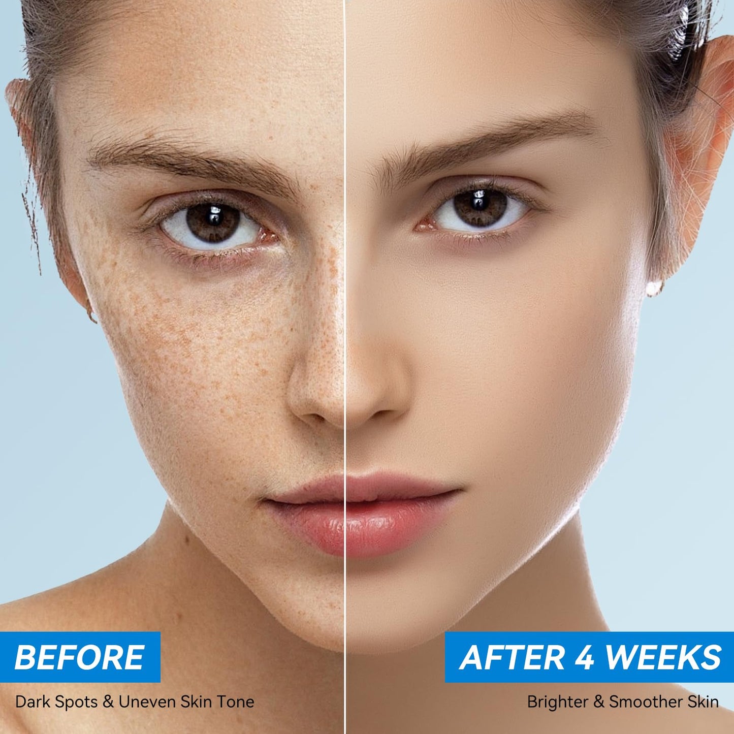 JURVEW1 Dark Spot Remover Face and Body, Dark Spot Corrector Cream for Age Spot Sun Spot Melasma Freckles, Rapid Corrects Uneven Skin Tone Beauty & Personal Care JURVEW1