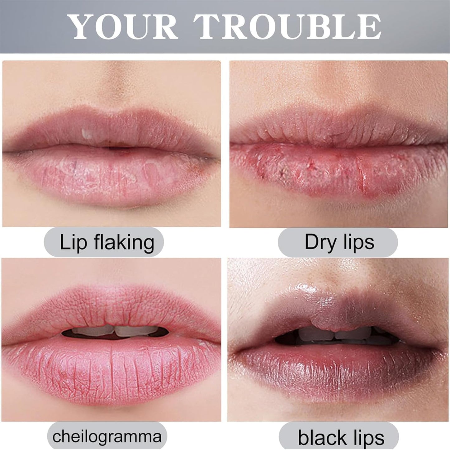 2PCS Lip Lightening Balm Dark Black Removal Exfoliation Pigmentation Fade Dull Pink Balm Anti-Crack Moisturizing Nourishing Lip Care Smokers Beauty and Personal Care Pozggoy