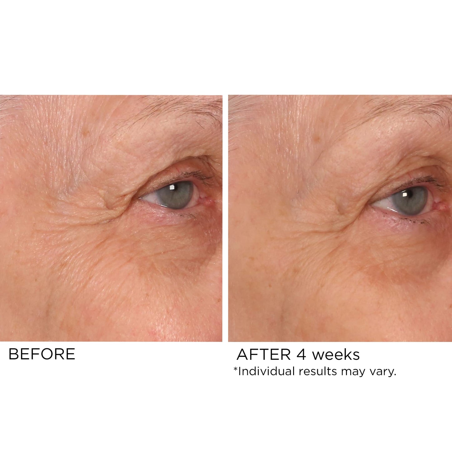 NassifMD Age Defying Eye Renewal Serum - Dual?Action Peptide Brightening for Wrinkles, Puffiness & Dark Circles Beauty & Personal Care NASSIFMD
