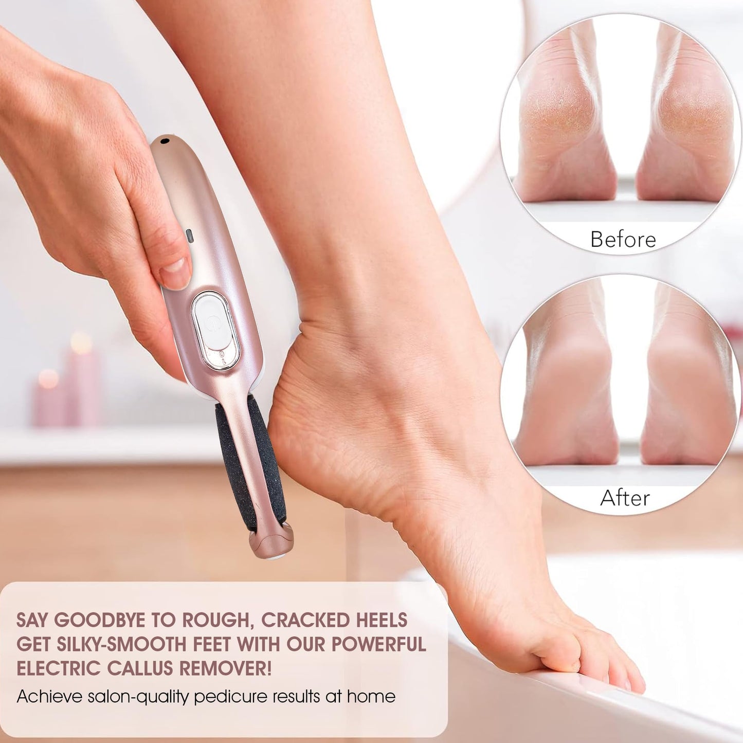 Powerful Electric Callus Remover Wand - Rechargeable Foot File, Grinder & Scrubber - Removes Dead, Hard Skin & Calluses - Best Pedicure Tool for Soft Beauty & Personal Care Care me