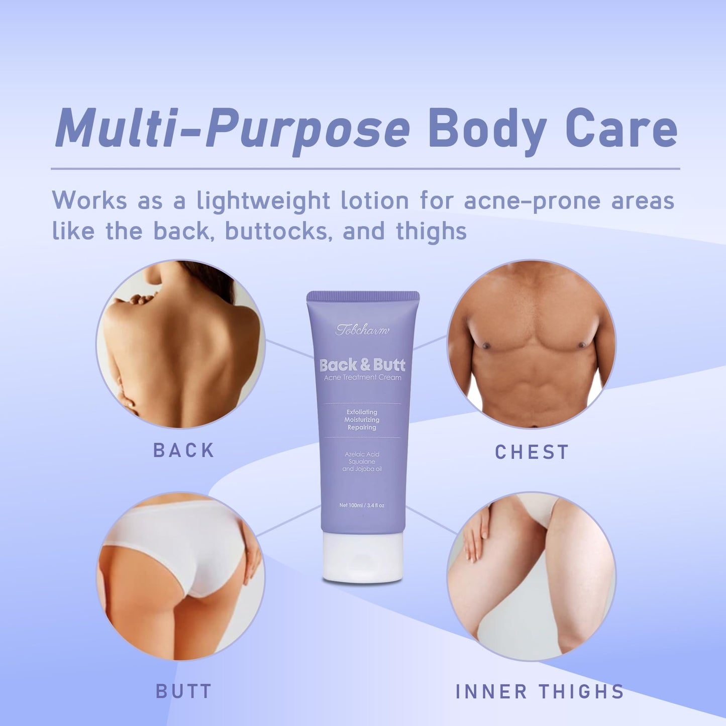 Butt Acne Clearing Treatment, Maximum Strength Body Cream for Back, Buttocks, Thigh & Chest Acne Removal, Skin Clearing Lotion for Men & Women Beauty & Personal Care Tobcharm