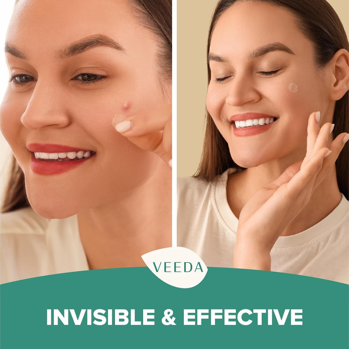 Veeda Glow Pimple Patches - Hydrocolloid Acne Stickers for Fast Healing, Invisible & Non-Irritating Zit Covers, Blemish Spot Treatment, 36 Count Beauty & Personal Care Veeda