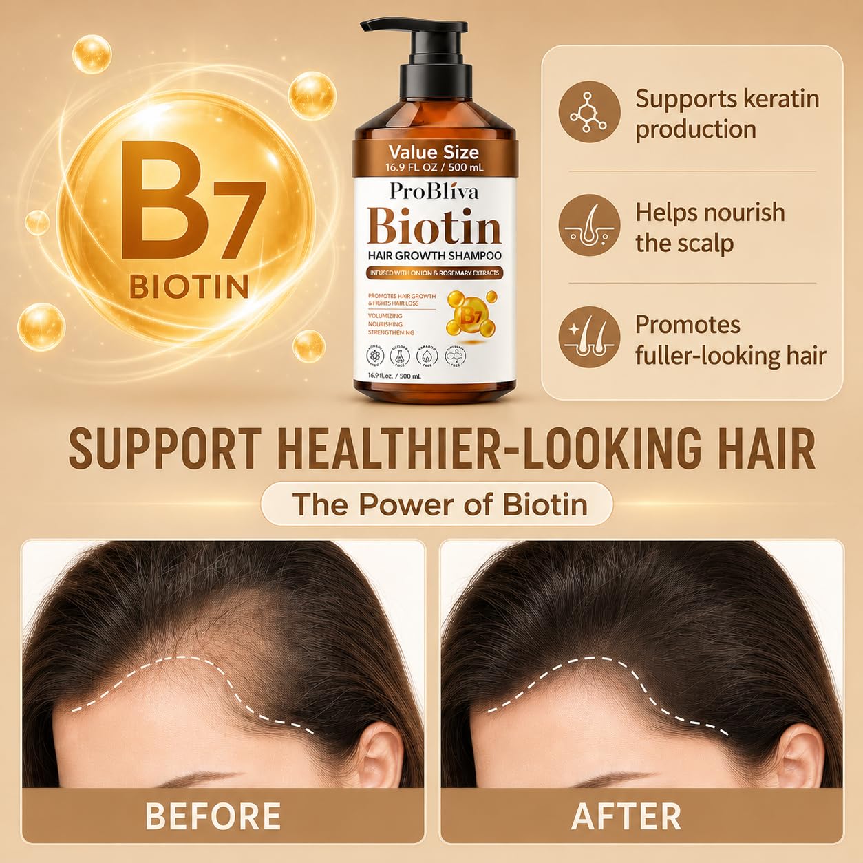 Biotin Hair Growth Shampoo for Thinning Hair in Adults 30+ - Strengthening Formula with Biotin & Rosemary - Reduces Shedding, Supports Fuller Beauty & Personal Care ProBliva