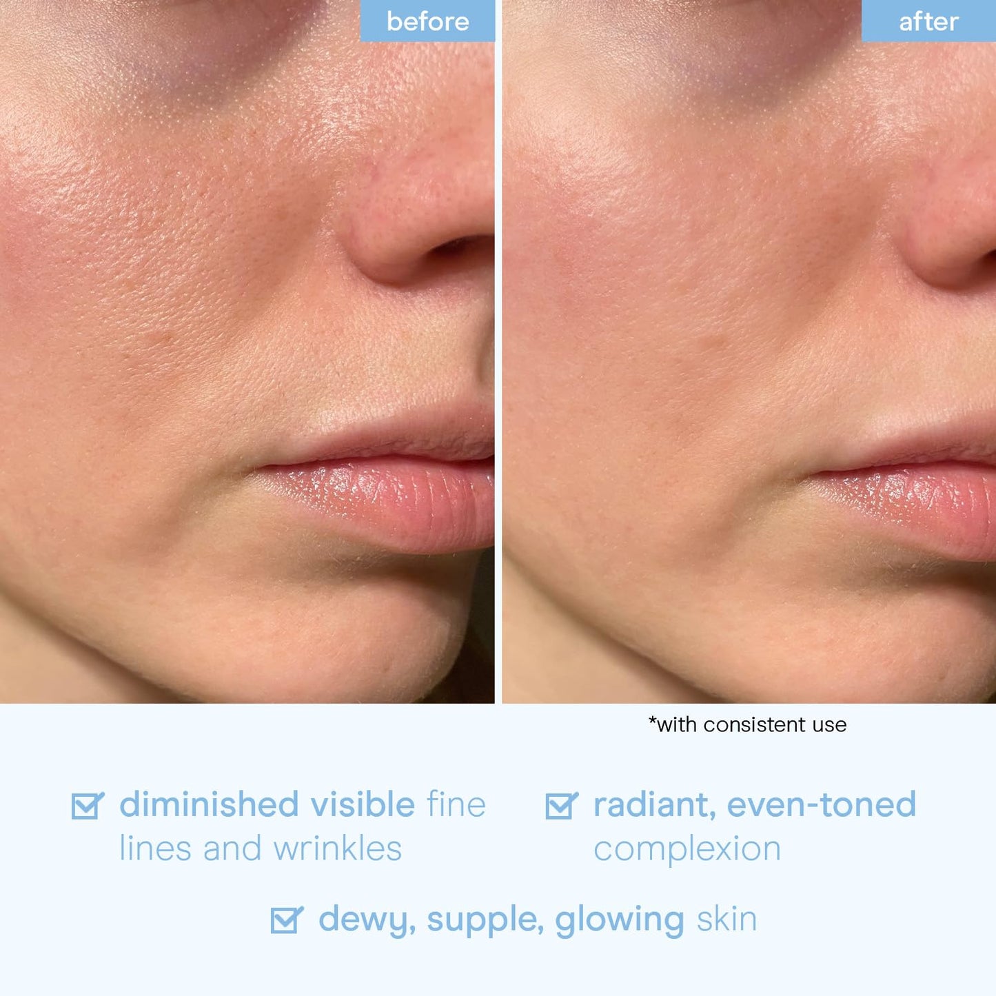 Baebody Snail Mucin Serum Moisturizer - Hydrating Serum for Face with Collagen - Snail Mucin Moisturizer for Youthful Skin - Korean Skin Care Beauty & Personal Care Baebody