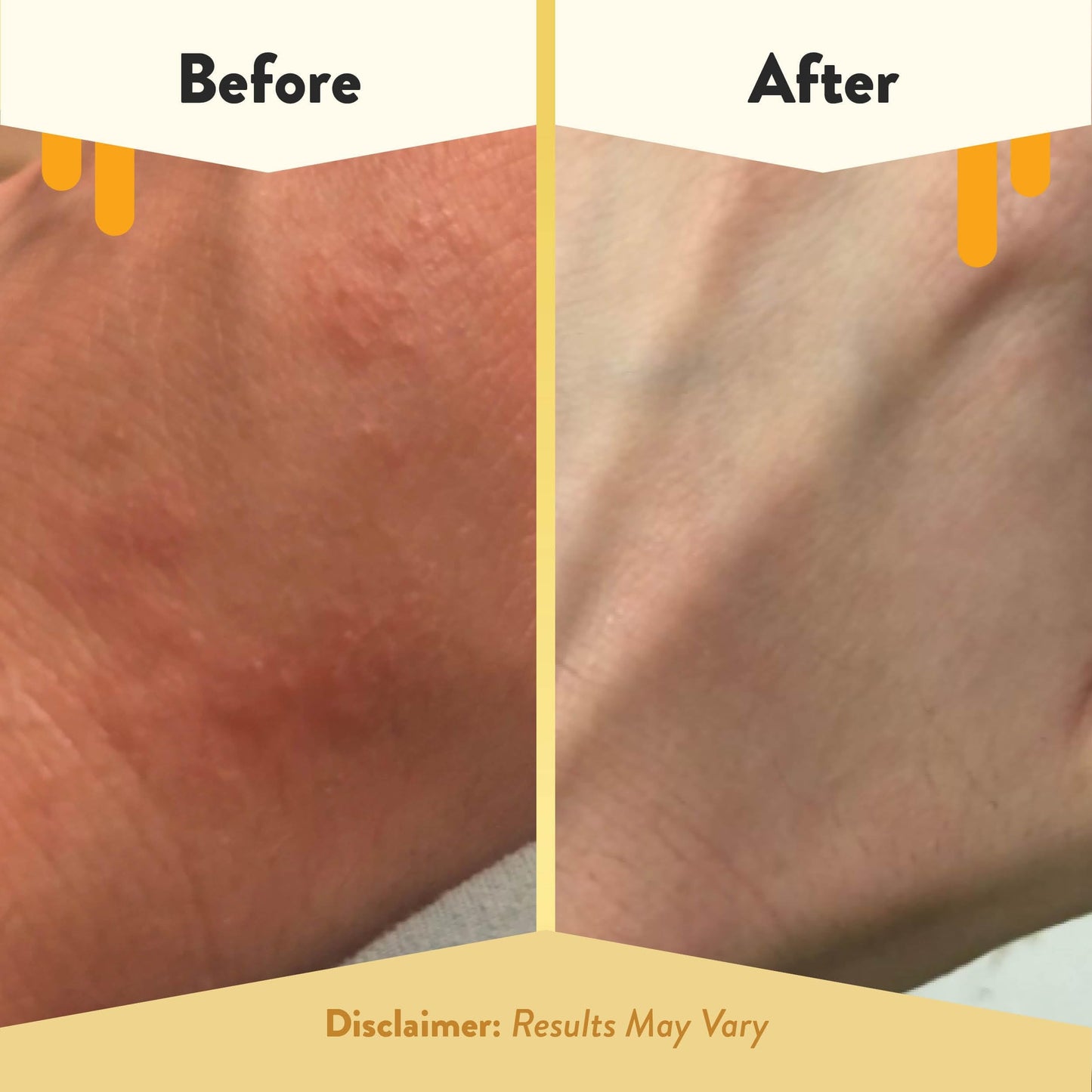 ECZEMA HONEY Oatmeal Body Lotion - Hand & Body Cream for Eczema Relief - Natural Dry Skin Repair (16 Oz) Beauty and Personal Care ECZEMA HONEY